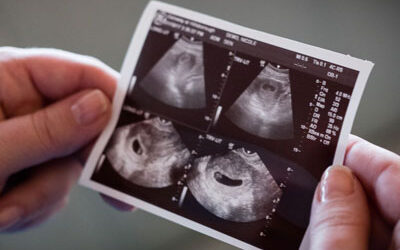 Planning to Abort: Why should I get an Ultrasound?