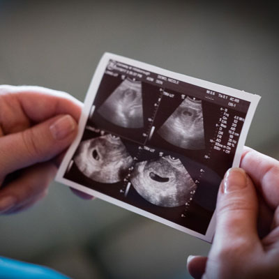Planning to Abort: Why should I get an Ultrasound?